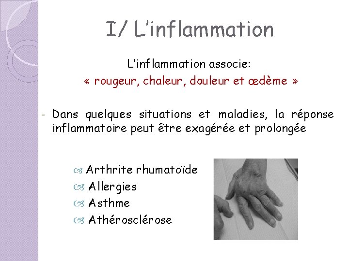 I/ L’inflammation associe: « rougeur, chaleur, douleur et œdème » - Dans quelques situations I/ L’inflammation associe: « rougeur, chaleur, douleur et œdème » - Dans quelques situations