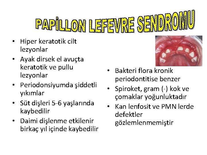  • Hiper keratotik cilt lezyonlar • Ayak dirsek el avuçta keratotik ve pullu