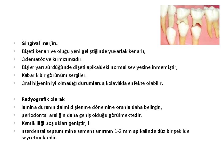  • • • Gingival marjin. Dişeti kenarı ve oluğu yeni geliştiğinde yuvarlak kenarlı,