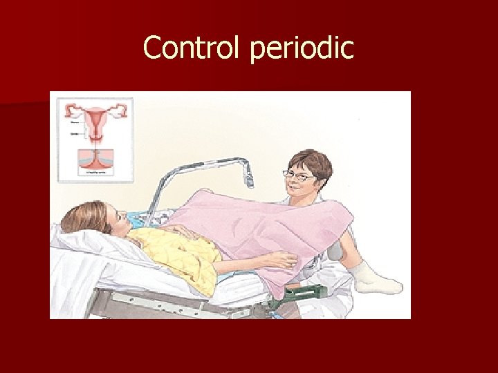 Control periodic 