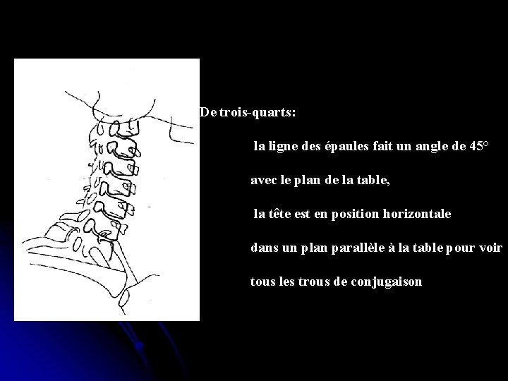 De trois-quarts: la ligne des épaules fait un angle de 45° avec le plan