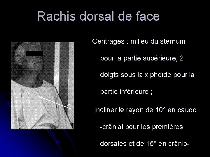 Rachis dorsal de face Centrages : milieu du sternum pour la partie supérieure, 2