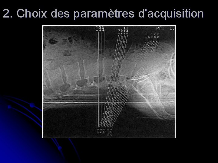 2. Choix des paramètres d'acquisition 