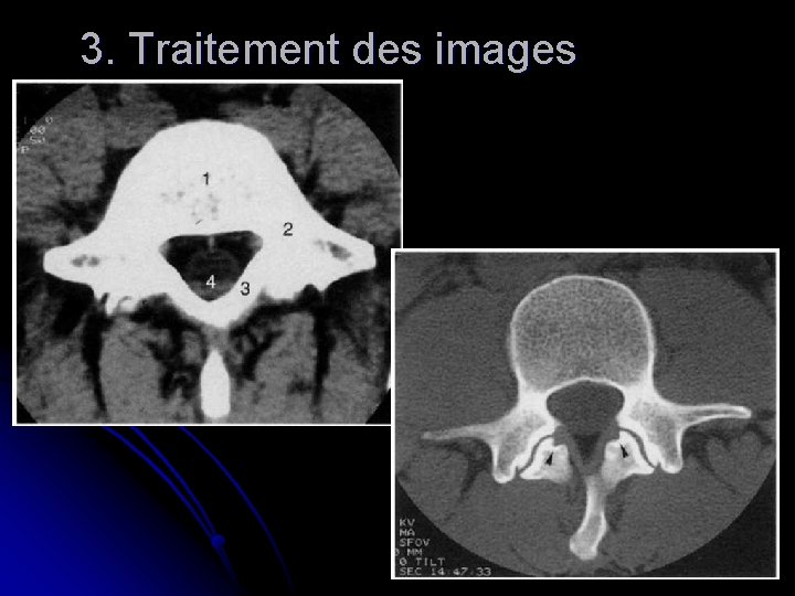 3. Traitement des images 