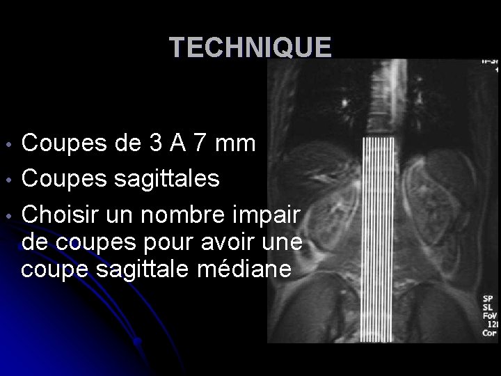 TECHNIQUE • • • Coupes de 3 A 7 mm Coupes sagittales Choisir un