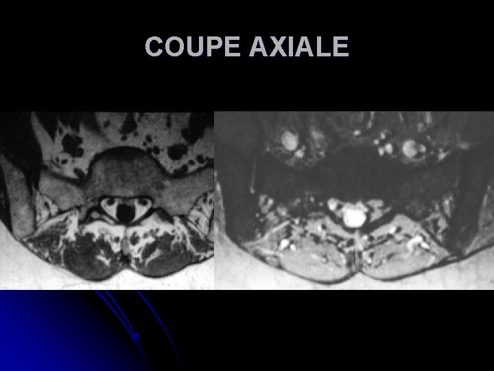 COUPE AXIALE 