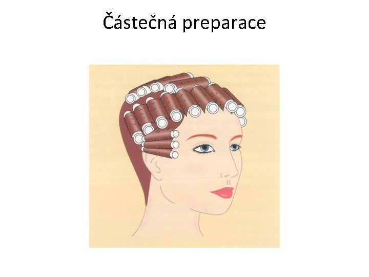 Částečná preparace 