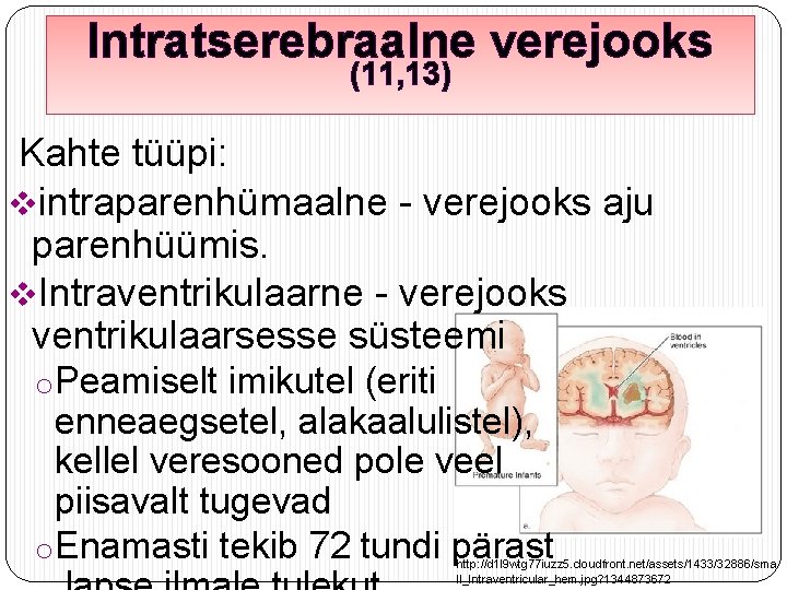 Intratserebraalne verejooks (11, 13) Kahte tüüpi: vintraparenhümaalne - verejooks aju parenhüümis. v. Intraventrikulaarne -