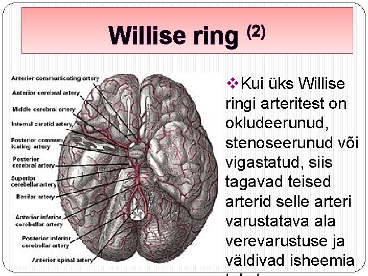 Willise ring (2) v. Kui üks Willise ringi arteritest on okludeerunud, stenoseerunud või vigastatud,