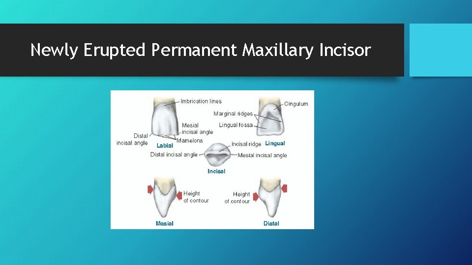 Newly Erupted Permanent Maxillary Incisor 