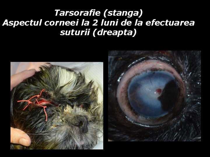 Tarsorafie (stanga) Aspectul corneei la 2 luni de la efectuarea suturii (dreapta) Tarsorafie (stanga) Aspectul corneei la 2 luni de la efectuarea suturii (dreapta)