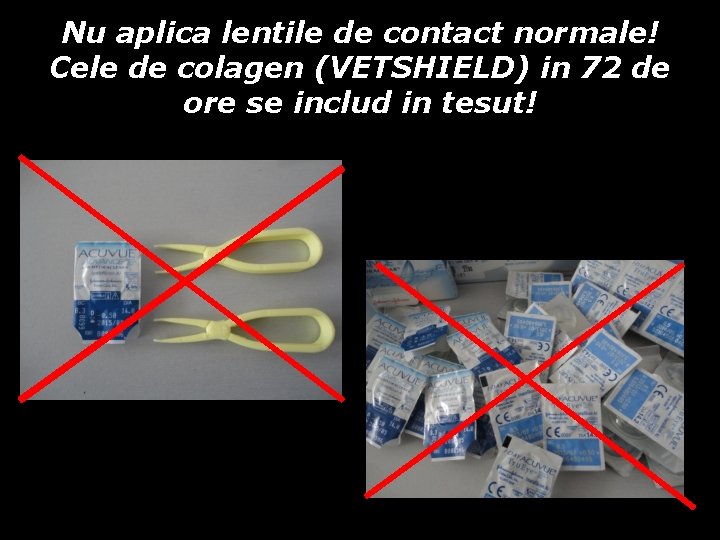 Nu aplica lentile de contact normale! Cele de colagen (VETSHIELD) in 72 de ore Nu aplica lentile de contact normale! Cele de colagen (VETSHIELD) in 72 de ore