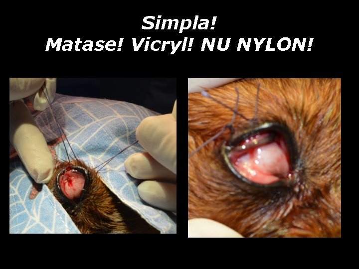 Simpla! Matase! Vicryl! NU NYLON! Simpla! Matase! Vicryl! NU NYLON!