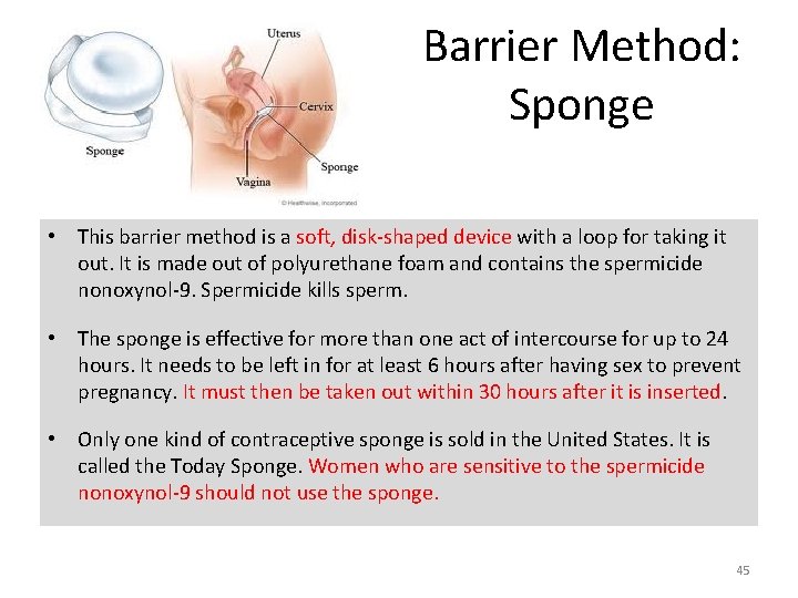 Barrier Method: Sponge • This barrier method is a soft, disk-shaped device with a