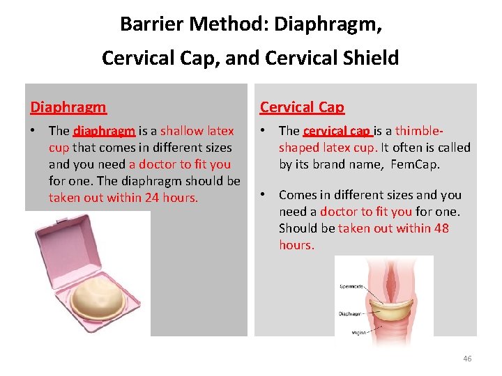 Barrier Method: Diaphragm, Cervical Cap, and Cervical Shield Diaphragm Cervical Cap • The diaphragm