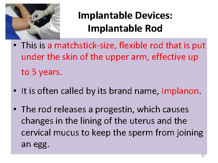 Implantable Devices: Implantable Rod • This is a matchstick-size, flexible rod that is put