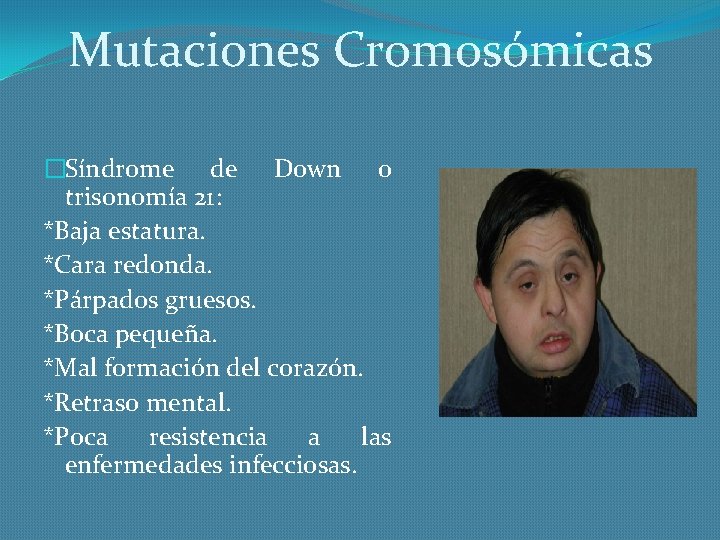 Mutaciones Cromosómicas �Síndrome de Down o trisonomía 21: *Baja estatura. *Cara redonda. *Párpados gruesos.
