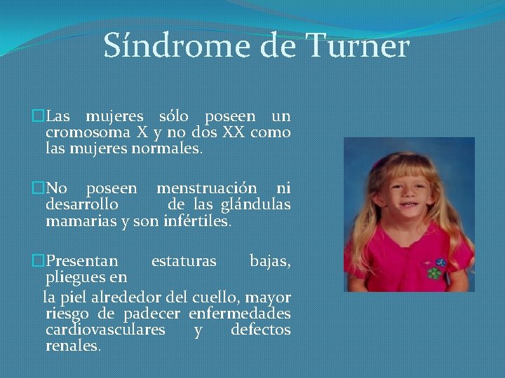 Síndrome de Turner �Las mujeres sólo poseen un cromosoma X y no dos XX