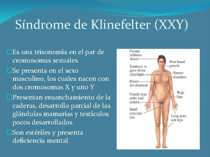 Síndrome de Klinefelter (XXY) �Es una trisonomía en el par de cromosomas sexuales. �Se