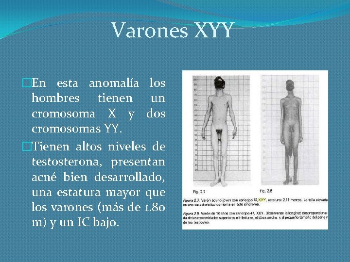 Varones XYY �En esta anomalía los hombres tienen un cromosoma X y dos cromosomas