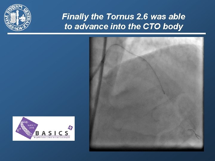 Finally the Tornus 2. 6 was able to advance into the CTO body 