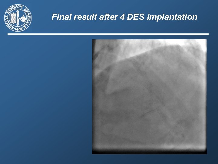 Final result after 4 DES implantation 