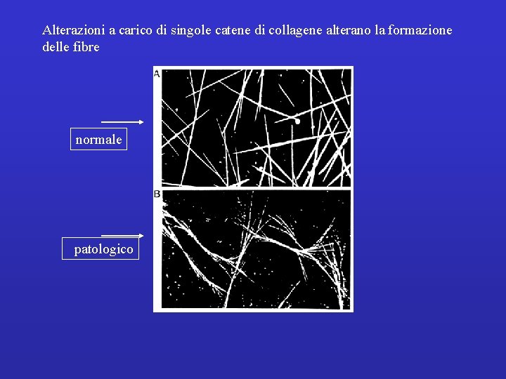 Alterazioni a carico di singole catene di collagene alterano la formazione delle fibre normale