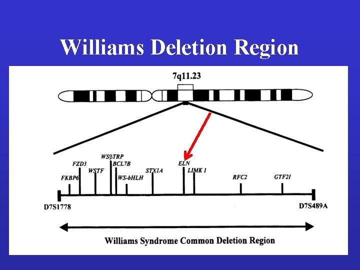 Williams Deletion Region 