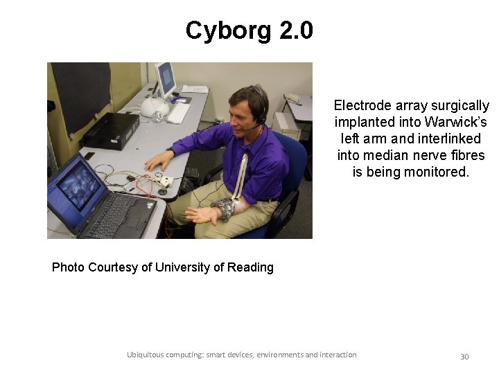 Cyborg 2. 0 Electrode array surgically implanted into Warwick’s left arm and interlinked into