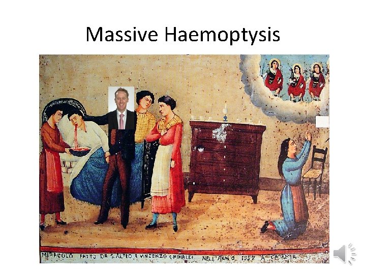 Massive Haemoptysis 