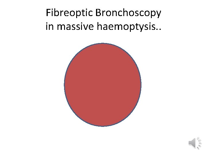 Fibreoptic Bronchoscopy in massive haemoptysis. . 
