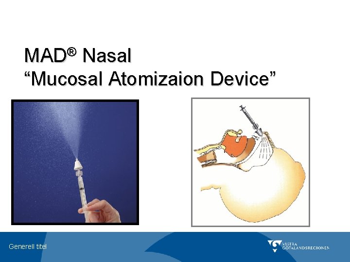 MAD® Nasal “Mucosal Atomizaion Device” Generell titel 