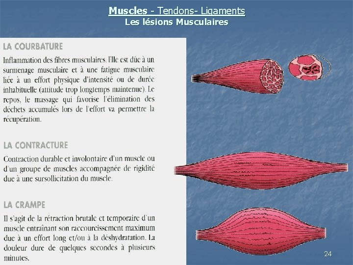 Muscles - Tendons- Ligaments Les lésions Musculaires 24 