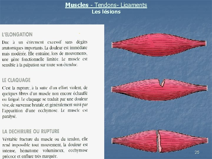 Muscles - Tendons- Ligaments Les lésions 25 