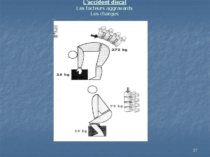L’accident discal Les facteurs aggravants Les charges 37 