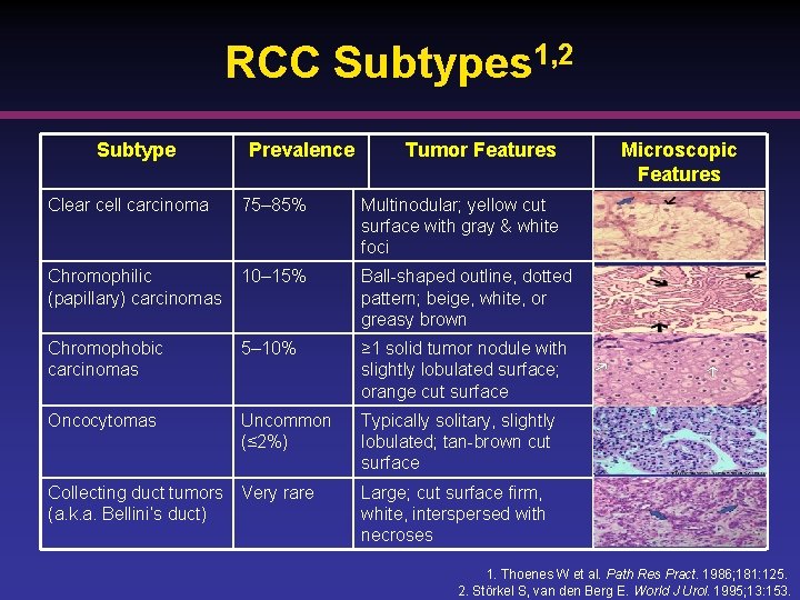 RCC Subtypes 1, 2 Subtype Prevalence Tumor Features Clear cell carcinoma 75– 85% Multinodular;