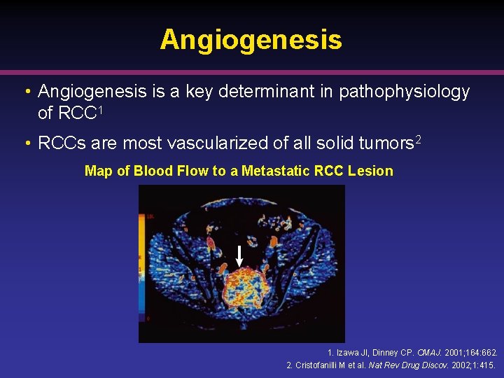 Angiogenesis • Angiogenesis is a key determinant in pathophysiology of RCC 1 • RCCs