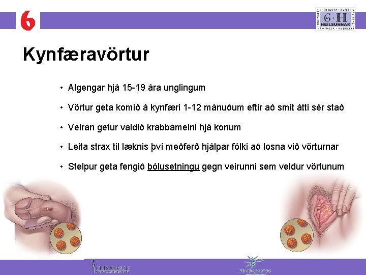 Kynfæravörtur • Algengar hjá 15 -19 ára unglingum • Vörtur geta komið á kynfæri