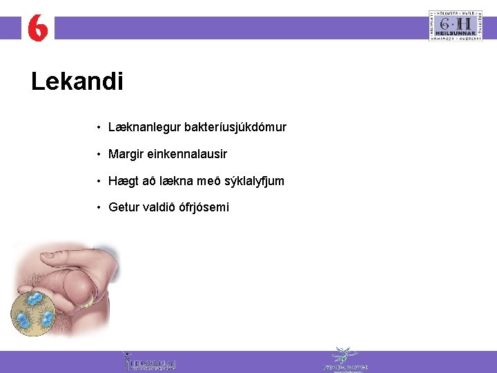 Lekandi • Læknanlegur bakteríusjúkdómur • Margir einkennalausir • Hægt að lækna með sýklalyfjum •