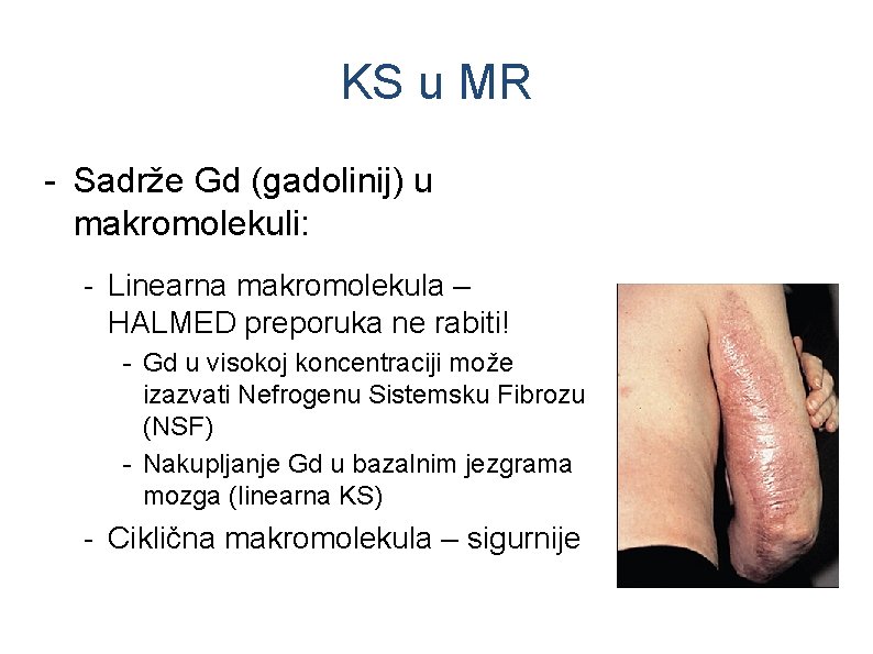 KS u MR - Sadrže Gd (gadolinij) u makromolekuli: - Linearna makromolekula – HALMED