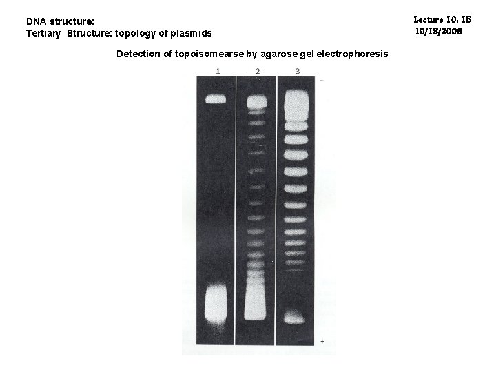 DNA structure: Tertiary Structure: topology of plasmids Detection of topoisomearse by agarose gel electrophoresis