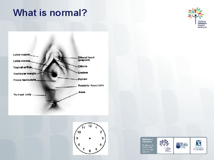 What is normal? 
