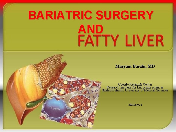 BARIATRIC SURGERY AND Maryam Barzin, MD Obesity Research Center Research Institute for Endocrine sciences