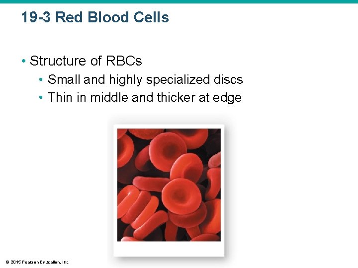 19 -3 Red Blood Cells • Structure of RBCs • Small and highly specialized