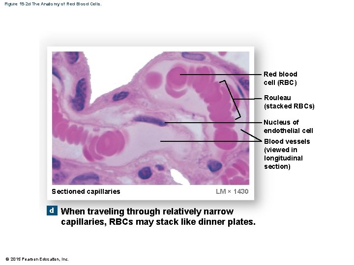 Figure 19 -2 d The Anatomy of Red Blood Cells. Red blood cell (RBC)