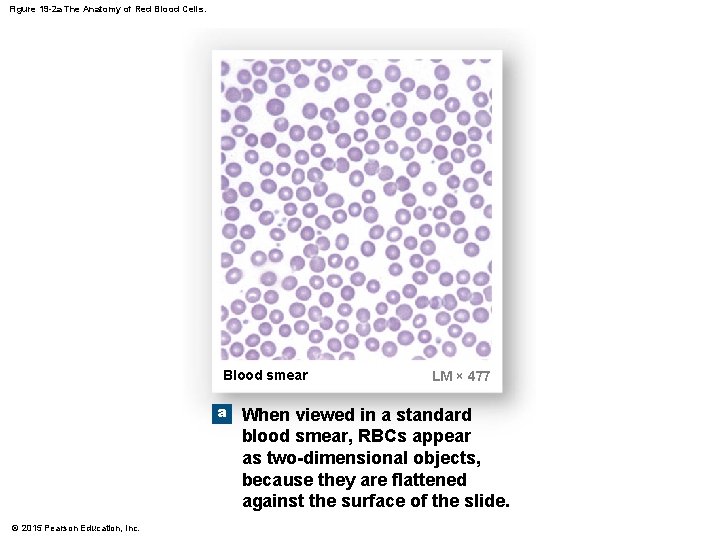 Figure 19 -2 a The Anatomy of Red Blood Cells. Blood smear a ©
