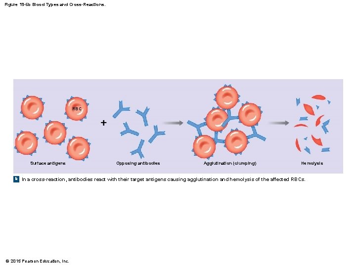 Figure 19 -6 b Blood Types and Cross-Reactions. RBC Surface antigens Opposing antibodies Agglutination