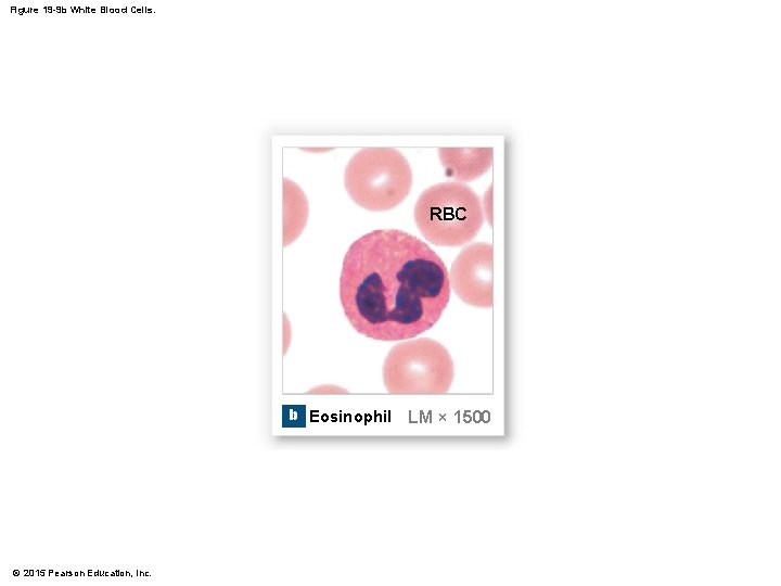 Figure 19 -9 b White Blood Cells. RBC b Eosinophil © 2015 Pearson Education,