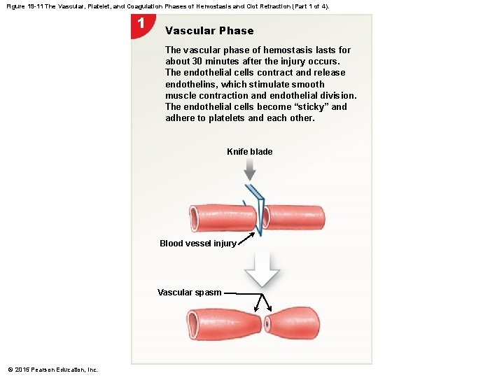 Figure 19 -11 The Vascular, Platelet, and Coagulation Phases of Hemostasis and Clot Retraction