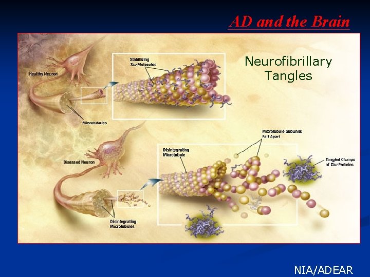 AD and the Brain Neurofibrillary Tangles . NIA/ADEAR 